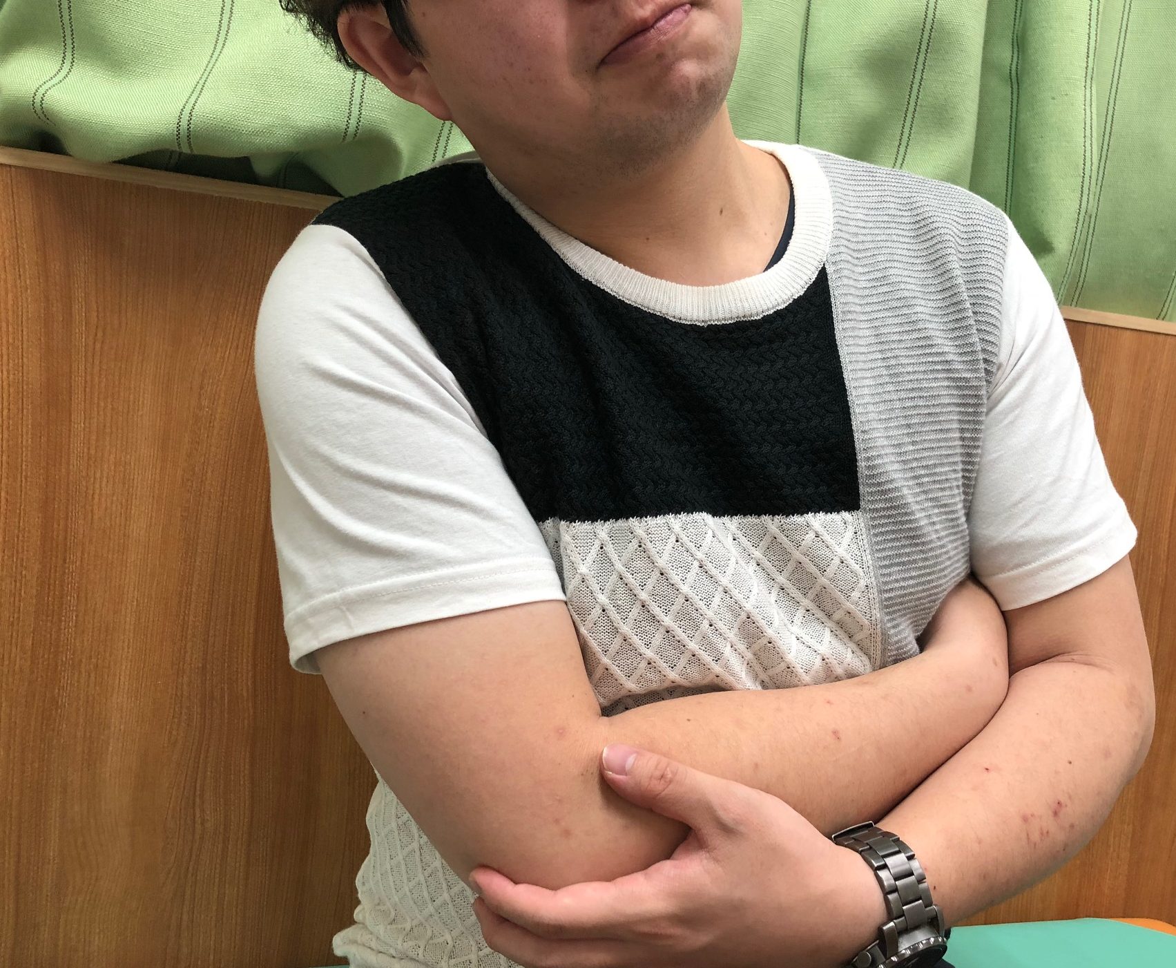 ラグビーでのケガ 鎖骨骨折 長崎市のはしぐち整骨院 日曜営業 交通事故治療 足底筋膜炎 ラグビーでのケガ 鎖骨骨折 長崎市のはしぐち整骨院 日曜営業 交通事故治療 足底筋膜炎